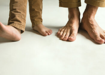 Bagaimana Mengatasi Rasa Lelah di Kaki